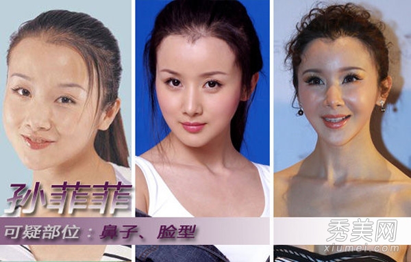 蔡康永“面瘫” 揭开明星整容失败真相