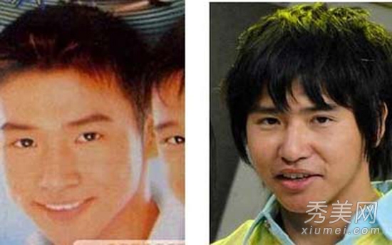 欧弟戴军李玟周迅 盘点割双眼皮的明星