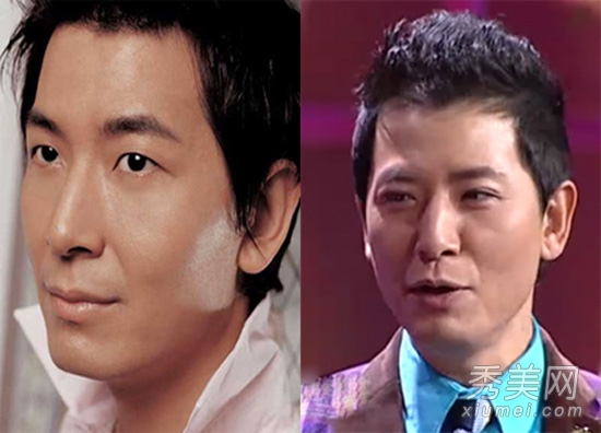 欧弟戴军李玟周迅 盘点割双眼皮的明星