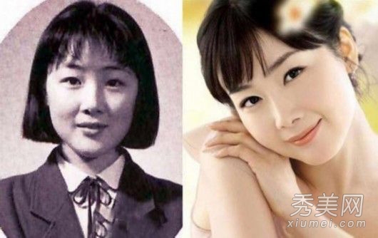 《可疑的保姆》崔智友 整容后遗症显尴尬