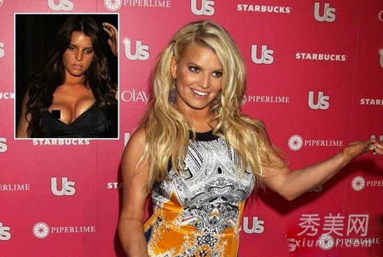 10���Ը�ŷ��Ů�Ǽ�͹¶��˲��