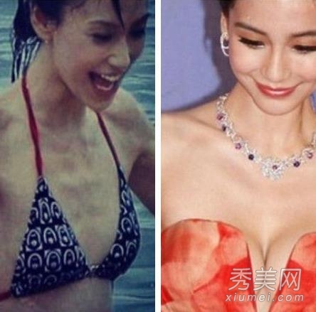 Angelababy�ز���� ���ٷ���������¡��