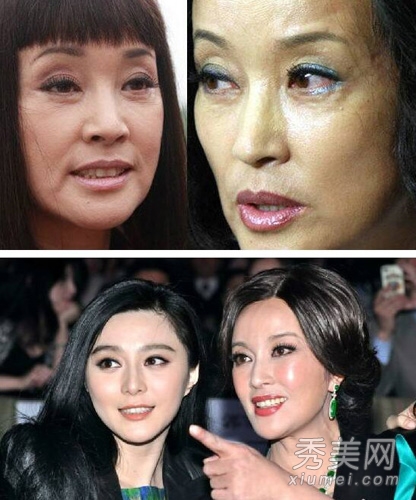港星公开整容 李丽珍被传整形失败
