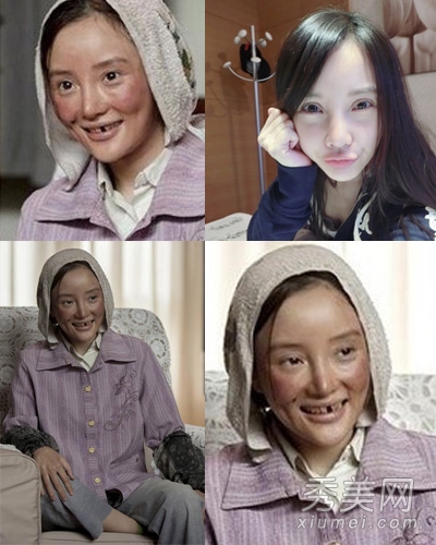 赵薇白百合“毁容”拍电影 越丑越火吗?