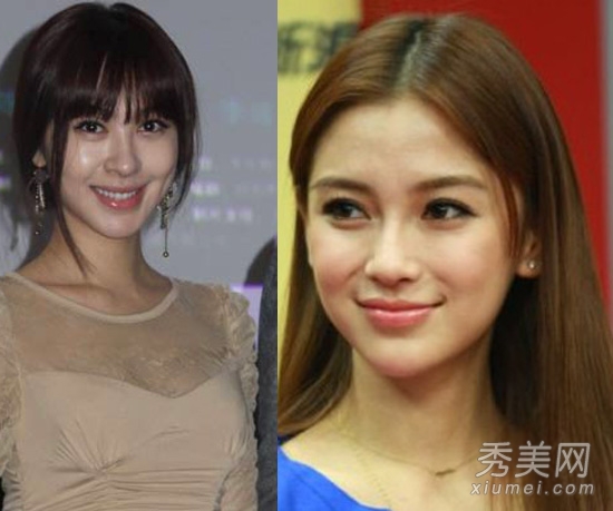 港星公开整容 李丽珍被传整形失败