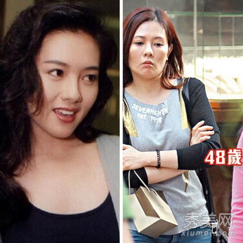 港星公开整容 李丽珍被传整形失败