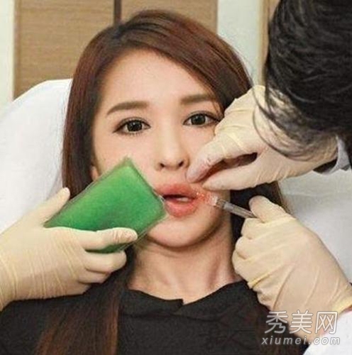 港星公开整容 李丽珍被传整形失败