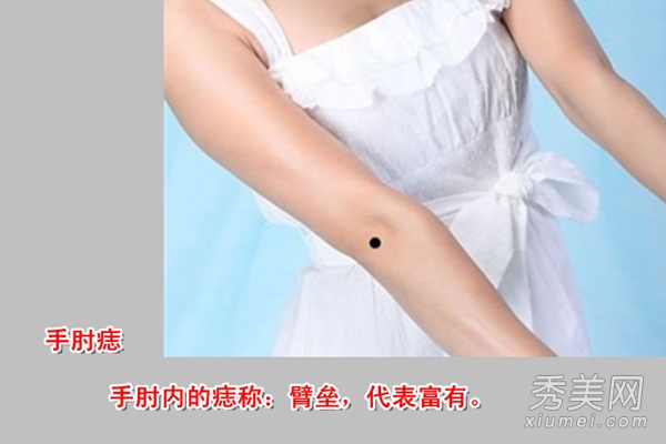 揭秘人体痣相解说 您是属什么呢