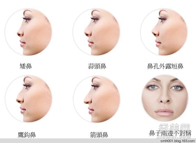揭秘人体痣相解说 您是属什么呢