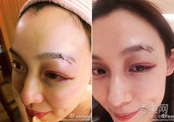 Ů�����������⡰���ݡ� ̨ģ�������沿����