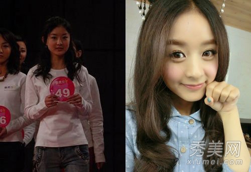 崔智友整容后遗症变残 揭女星整容对比照