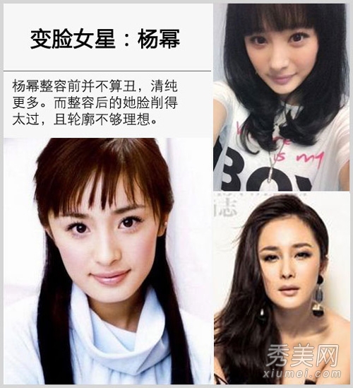 崔智友整容后遗症变残 揭女星整容对比照