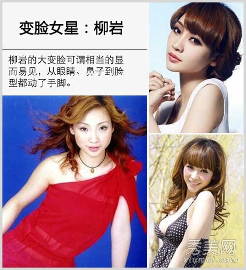 崔智友整容后遗症变残 揭女星整容对比照