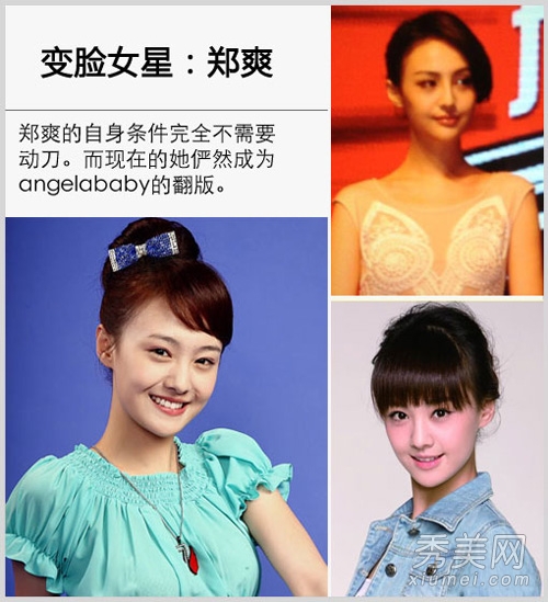 崔智友整容后遗症变残 揭女星整容对比照