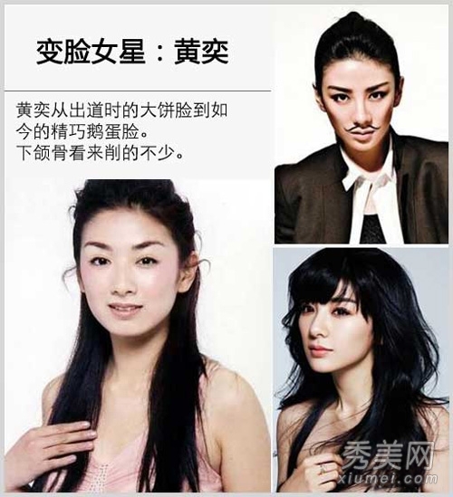 崔智友整容后遗症变残 揭女星整容对比照