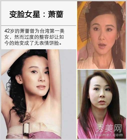 崔智友整容后遗症变残 揭女星整容对比照