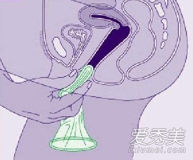 ��ͼ��ϸ��ʾŮ�ñ����׵��÷�