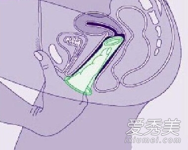 ��ͼ��ϸ��ʾŮ�ñ����׵��÷�