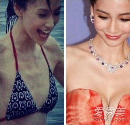 angelababy隆胸了?揭女明星隆胸疑团