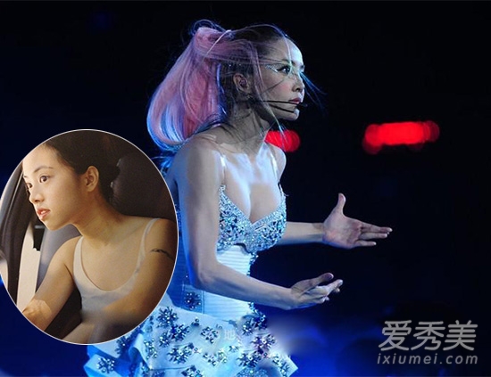 angelababy隆胸了?揭女明星隆胸疑团