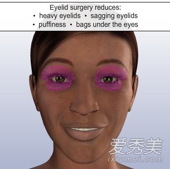 ���γ�ʶ��˫��Ƥ�������̣�ģ��ͼ��