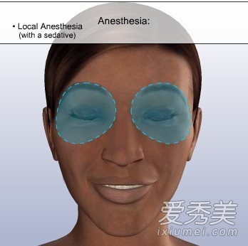 ���γ�ʶ��˫��Ƥ�������̣�ģ��ͼ��