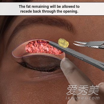 ���γ�ʶ��˫��Ƥ�������̣�ģ��ͼ��