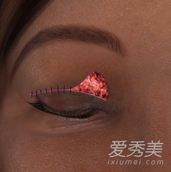 ���γ�ʶ��˫��Ƥ�������̣�ģ��ͼ��