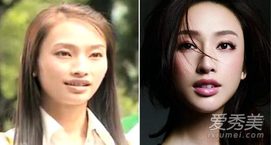 昆凌张馨予张俪 女星整容前丑照大曝光_女星整容对比照