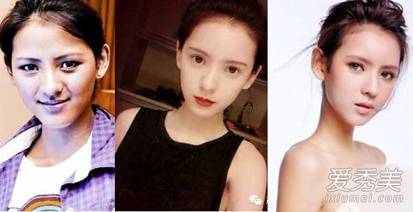 昆凌张馨予张俪 女星整容前丑照大曝光_女星整容对比照