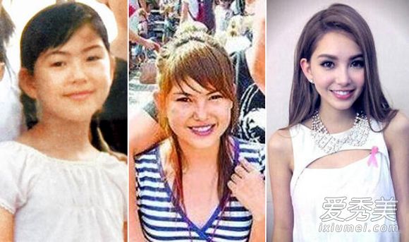 昆凌张馨予张俪 女星整容前丑照大曝光_女星整容对比照