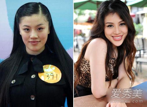 昆凌张馨予张俪 女星整容前丑照大曝光_女星整容对比照