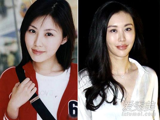 昆凌张馨予张俪 女星整容前丑照大曝光_女星整容对比照