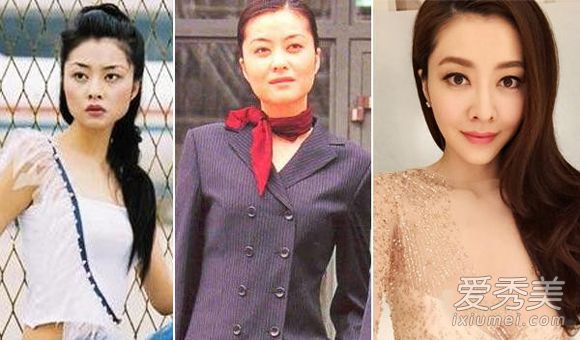 昆凌张馨予张俪 女星整容前丑照大曝光_女星整容对比照