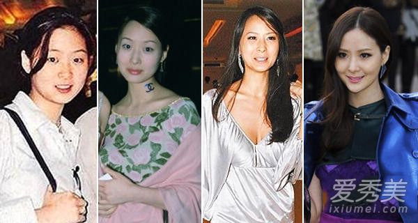 昆凌张馨予张俪 女星整容前丑照大曝光_女星整容对比照