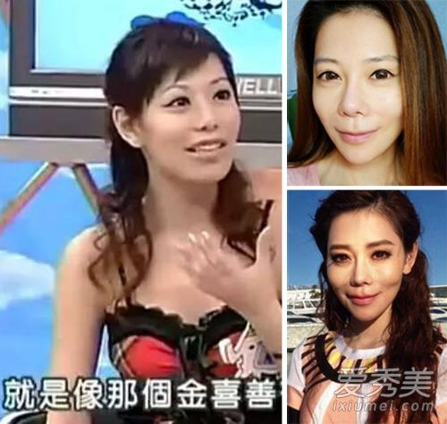 台星斯容18岁整容 21年60次整形上瘾了!