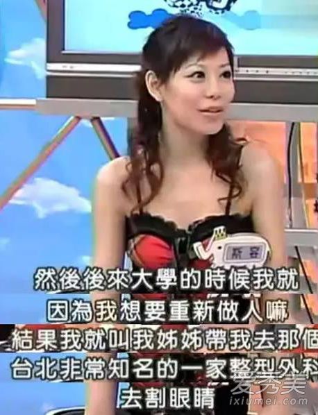 台星斯容18岁整容 21年60次整形上瘾了!