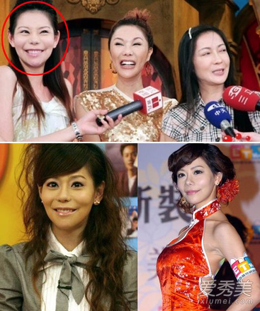 台星斯容18岁整容 21年60次整形上瘾了!