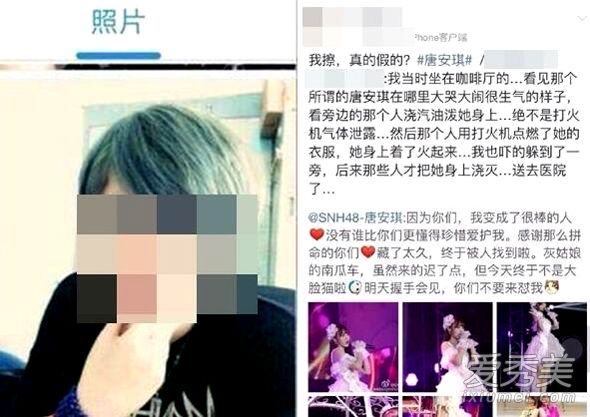 23岁唐安琪烧伤真相曝光 疑遭女伴泼汽油_唐安琪烧伤始末