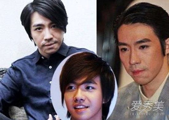 俞灏明烧伤后真实素颜照 俞灏明个人资料背景烧伤前后对比