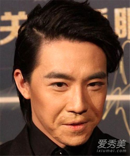 俞灏明烧伤后真实素颜照 俞灏明个人资料背景烧伤前后对比