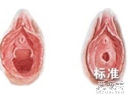 处女膜长什么样?处女膜的真正作用是什么?_处女膜有什么作用