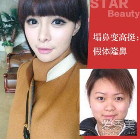 ���γ�¶������²� ����ǰ��Ա���Ƭ�ع�_���γ����ݶԱ�