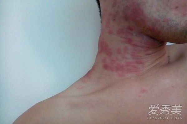 ��Ƥ�ߡ����˻���ʹ����ô�ˣ���״���������_��״������ʹ��ô�죿