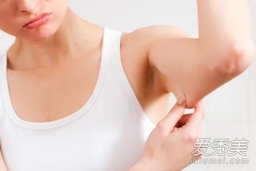 蝴蝶臂是怎么形成的 蝴蝶臂的图片什么样子