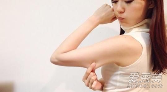 蝴蝶臂是怎么形成的 蝴蝶臂的图片什么样子