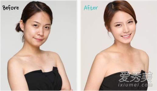 削骨瘦脸手术多少钱 削骨瘦脸手术能管几年