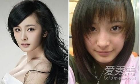 削骨瘦脸手术多少钱 削骨瘦脸手术能管几年