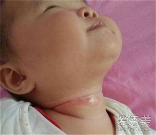 �Ͳ�����ʲô�õĿ� �Ͳ��ӿ������ϲ�����