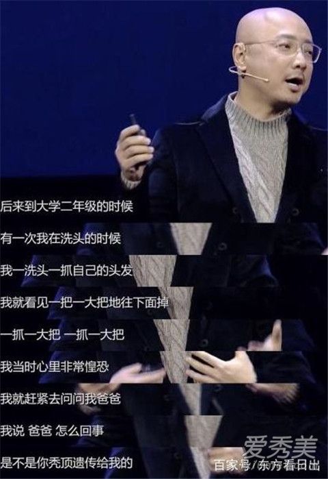 徐峥自曝20岁秃顶怎么回事 徐峥为什么20岁秃顶